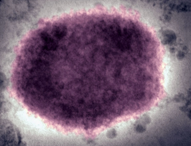 Bệnh đậu mùa khỉ: Virus gây bệnh nguy hiểm như thế nào? - Ảnh 2. Bệnh đậu mùa khỉ: Virus gây bệnh nguy hiểm như thế nào? - Ảnh 2.