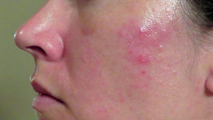 photo-1653107151036