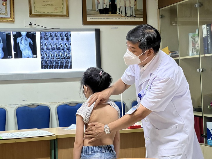 Cong vẹo cột sống ở trẻ, không phát hiện sớm, chữa trị kịp thời sẽ gây nhiều hệ luỵ - Ảnh 1. Cong vẹo cột sống ở trẻ, không phát hiện sớm, chữa trị kịp thời sẽ gây nhiều hệ luỵ - Ảnh 1.