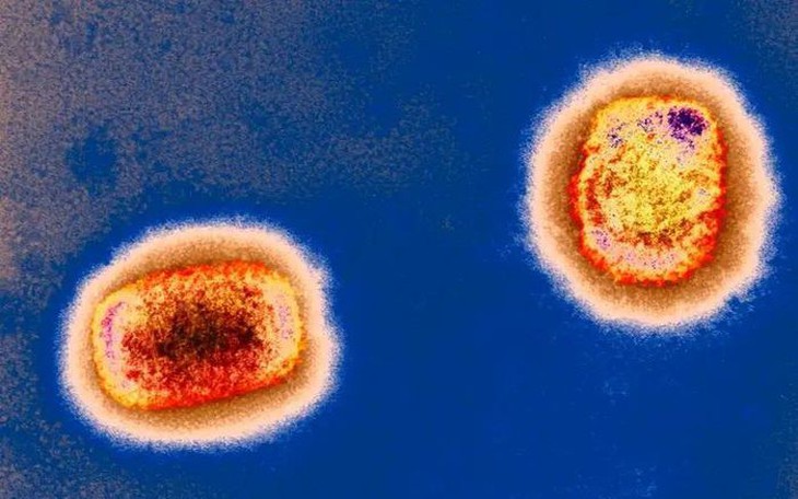 Bỉ cách ly 21 ngày với người mắc bệnh đậu mùa khỉ; Anh bắt đầu triển khai tiêm vaccine