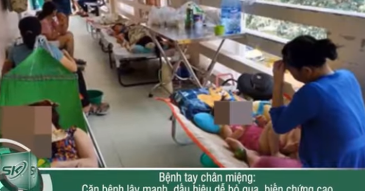Dấu hiệu không thể bỏ qua của bệnh chân tay miệng, phụ huynh cần lưu lại