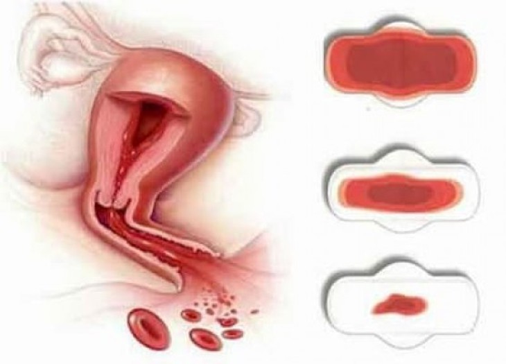 Thế nào là kinh nguyệt bình thường? - Ảnh 4.