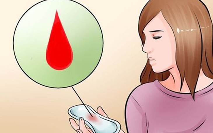 Chu kỳ kinh nguyệt nói lên điều gì về sức khỏe của phụ nữ?