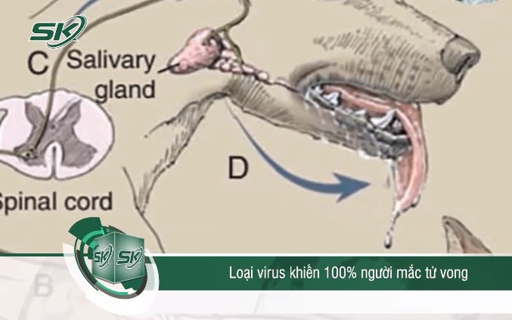 Bệnh dại là loại virus khiến 100% người mắc tử vong