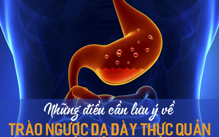 Trào ngược dạ dày thực quản: Nguyên nhân, triệu chứng và điều trị 
