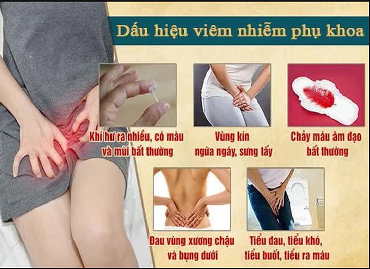 Biến chứng nguy hiểm của bệnh phụ khoa - Giải pháp nào xử lý hiêu quả? - Ảnh 1. Biến chứng nguy hiểm của bệnh phụ khoa - Giải pháp nào xử lý hiêu quả? - Ảnh 1.