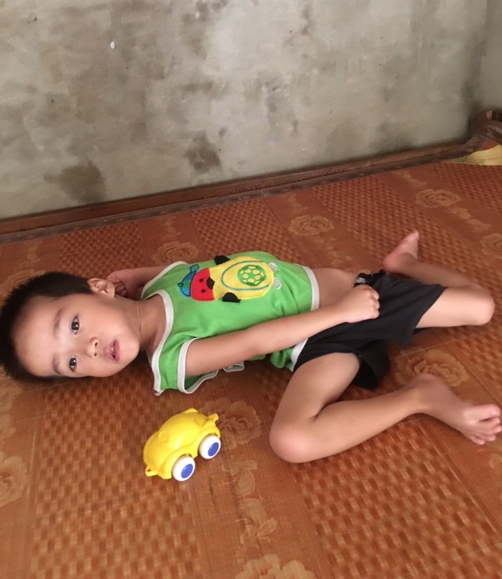Vợ chồng tật nguyền cầu xin sự sống cho hai đứa con bại não - Ảnh 3. Vợ chồng tật nguyền cầu xin sự sống cho hai đứa con bại não - Ảnh 3.