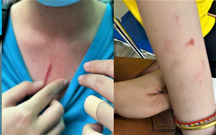 Vụ bạo lực học đường tại trường quốc tế: Làm gì khi trẻ bị bắt nạt?