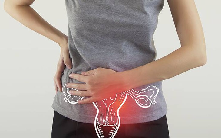 Tắc vòi trứng gây vô sinh ở phụ nữ?