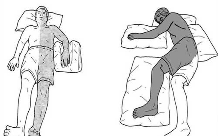 Chăm sóc người bệnh đột quỵ đúng cách: Những lưu ý cần nhớ