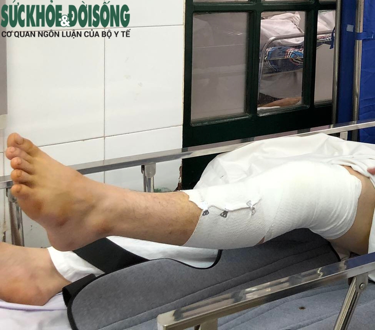 Va chạm khi đá bóng, nam thanh niên bị đứt dây chằng chéo đầu gối - Ảnh 3.