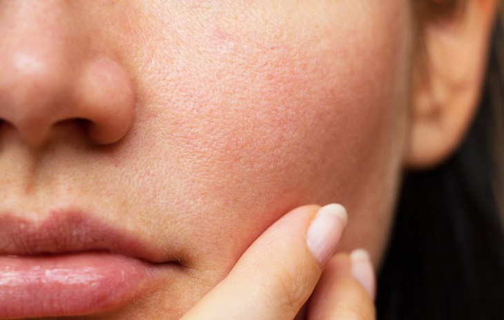 Thay đổi thói quen ăn uống, bí quyết để có làn da săn chắc, trẻ đẹp - Ảnh 2. Thay đổi thói quen ăn uống, bí quyết để có làn da săn chắc, trẻ đẹp - Ảnh 2.
