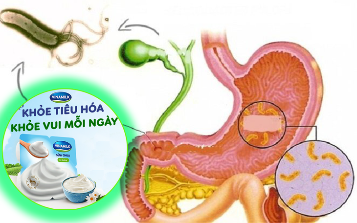Vai trò của dinh dưỡng đối với sức khỏe đường ruột