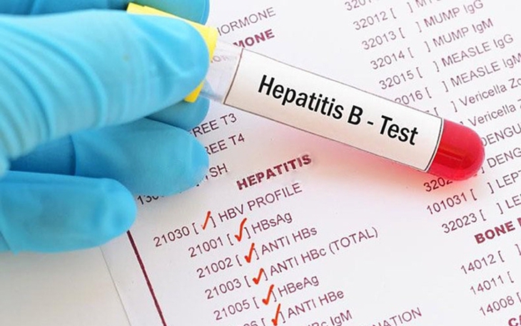 Bộ Y tế: Phát hiện sớm các trường hợp nhiễm virus viêm gan cấp tính, điều trị kịp thời, hạn chế biến chứng