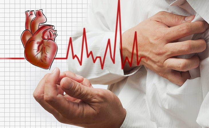 Vảy nến có nguy hiểm không? Điều trị bệnh bằng cách nào? - Ảnh 1.