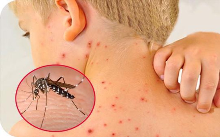 Đã có hơn 52.000 ca mắc sốt xuất huyết, 29 trường hợp tử vong: Bộ Y tế cảnh báo cao điểm mùa dịch