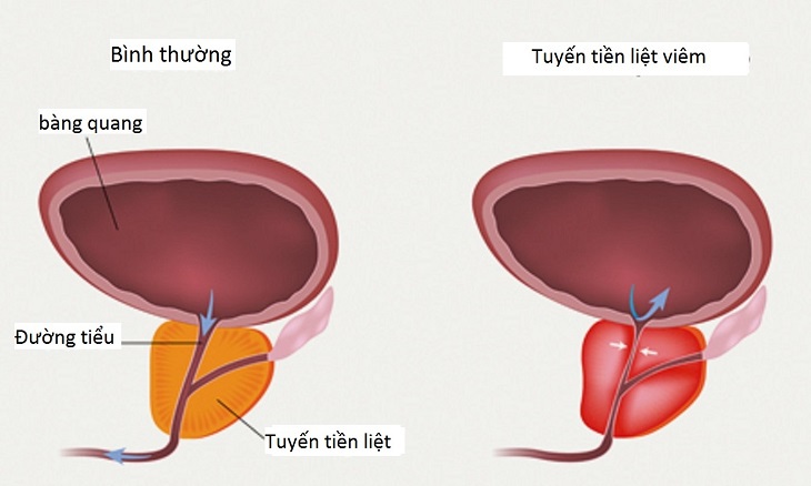 Đau dạ dày sau quan hệ tình dục có phải là nguyên nhân đáng lo ngại? - Ảnh 4.