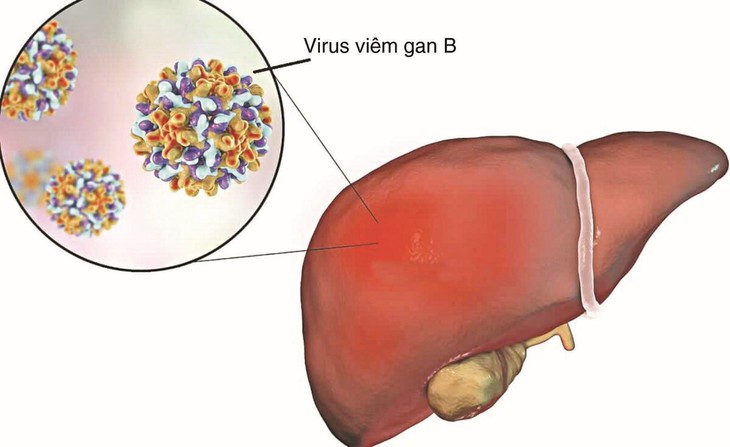 Các thuốc điều trị viêm gan B - Ảnh 1.