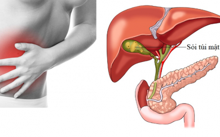 Chứng đầy hơi nguyên nhân và cách khắc phục
