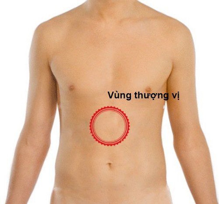 4 bài thuốc chữa đau dạ dày do vị tích trệ - Ảnh 2.