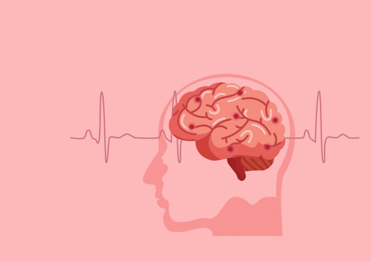 Thiếu máu não thoáng qua xảy ra do sự ngừng tạm thời việc cung cấp máu lên não. Thiếu máu não thoáng qua xảy ra do sự ngừng tạm thời việc cung cấp máu lên não.