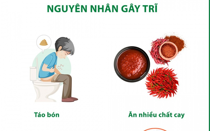 Thói quen xấu khiến nhiều người có nguy cơ mắc bệnh trĩ