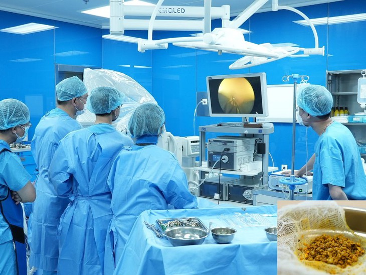 Bệnh nhân 33 tuổi thoát nguy cơ cắt túi mật do sỏi nhờ tán sỏi mật qua da bằng laser - Ảnh 2. Bệnh nhân 33 tuổi thoát nguy cơ cắt túi mật do sỏi nhờ tán sỏi mật qua da bằng laser - Ảnh 2.