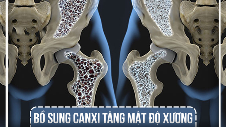 Báo động thực trạng chuột rút, loãng xương ở người cao tuổi - Ảnh 2.