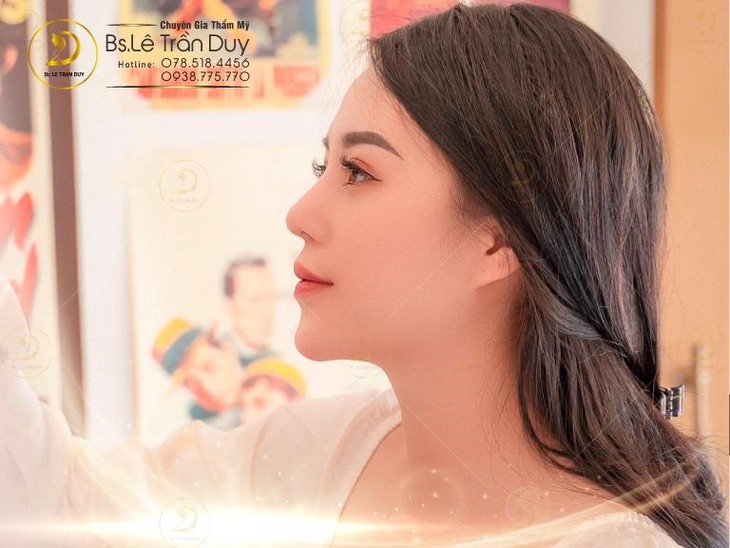 Nâng mũi ở bác sĩ thẩm mỹ giỏi nhiều người đợi 1 tháng - Ảnh 3.