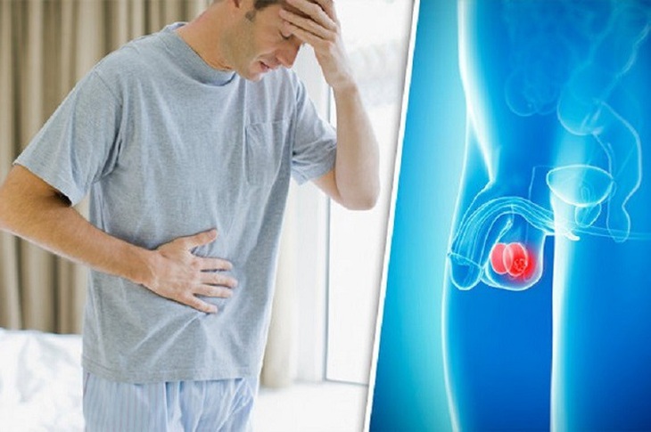 Giải đáp những thắc mắc về hội chứng đau tinh hoàn - Ảnh 4.