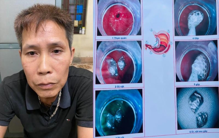Gặp công an, nuốt luôn ma túy phi tang - Ảnh 1. Gặp công an, nuốt luôn ma túy phi tang - Ảnh 1.