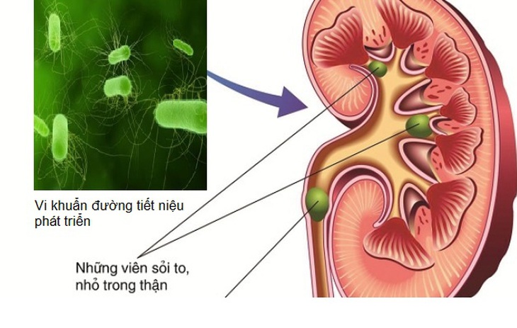 Xuất tinh bên trong âm đạo có thể gây ra chuột rút cho phụ nữ? - Ảnh 5. Xuất tinh bên trong âm đạo có thể gây ra chuột rút cho phụ nữ? - Ảnh 5.