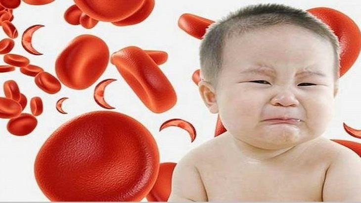 Trẻ lười ăn, kén ăn, chậm biết đi có phải thiếu máu không? - Ảnh 3.