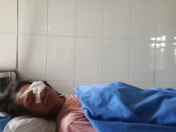 Đất văng vào mắt trong lúc làm việc, người phụ nữ có nguy cơ mù mắt - Ảnh 1.