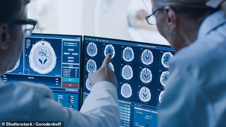 Phát hiện bệnh Alzheimer giai đoạn sớm với độ chính xác gần 100% - Ảnh 1.
