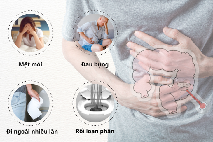 Hỗ trợ cải thiện viêm đại tràng bằng men vi sinh từ Kim chi Hàn Quốc - Ảnh 1. Hỗ trợ cải thiện viêm đại tràng bằng men vi sinh từ Kim chi Hàn Quốc - Ảnh 1.