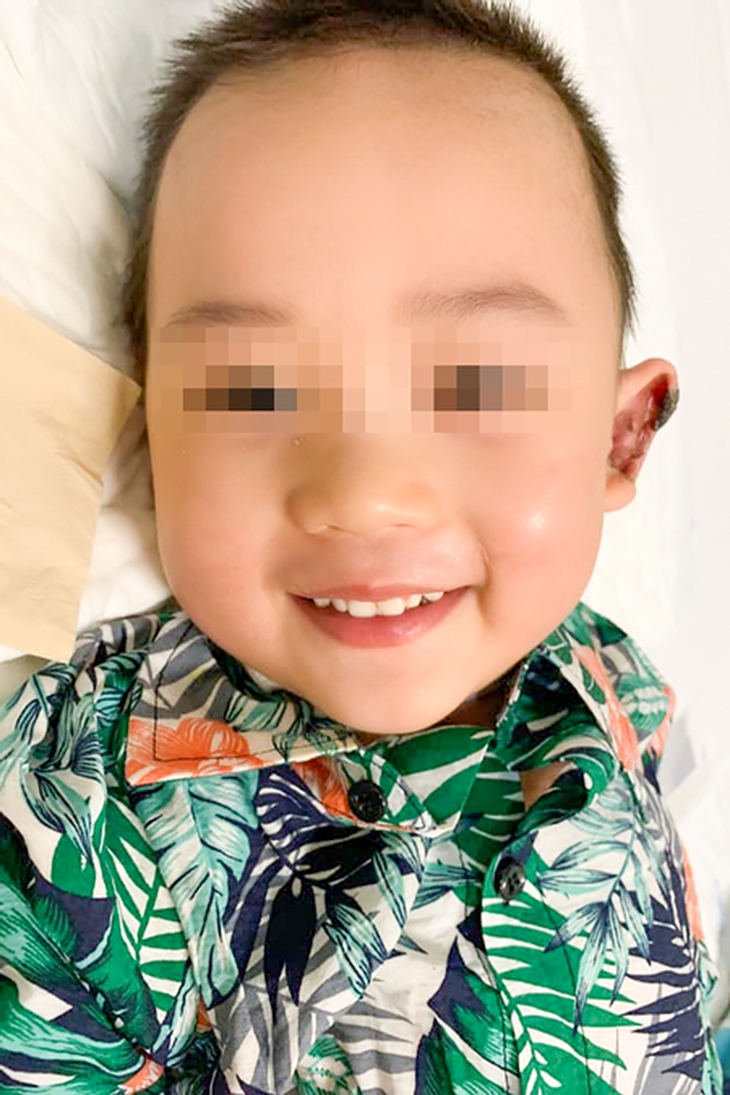Bé trai sốc phản vệ, suy tuần hoàn sau dùng kháng sinh   - Ảnh 4.