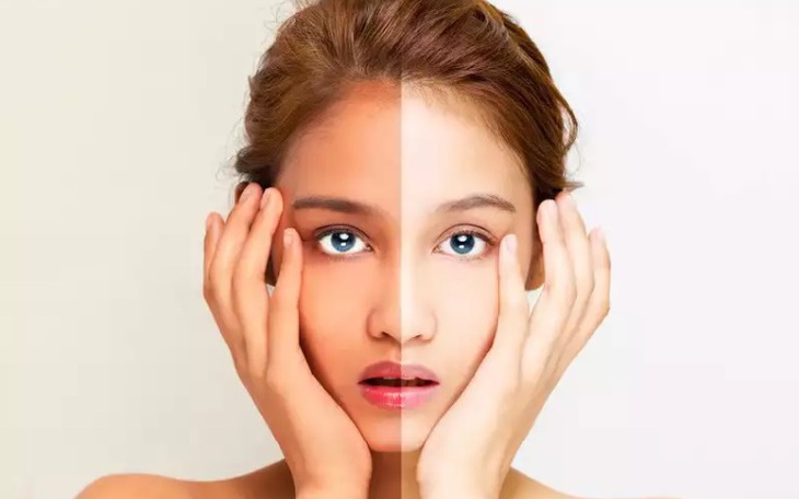 Cách chữa làn da bị cháy nắng hiệu quả nhất tại nhà
