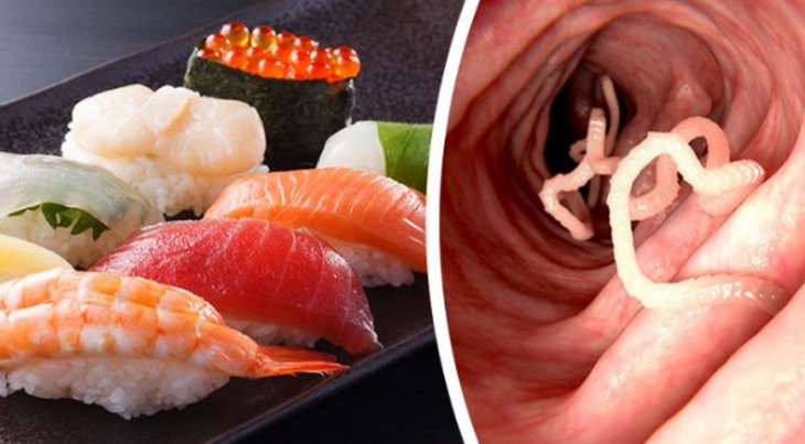 Điểm mặt ký sinh trùng gây bệnh viêm màng não ở người do ăn đồ tái sống - Ảnh 1.