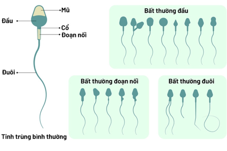 Hình thái tinh trùng ảnh hưởng đến khả năng sinh sản như thế nào? - Ảnh 4. Hình thái tinh trùng ảnh hưởng đến khả năng sinh sản như thế nào? - Ảnh 4.