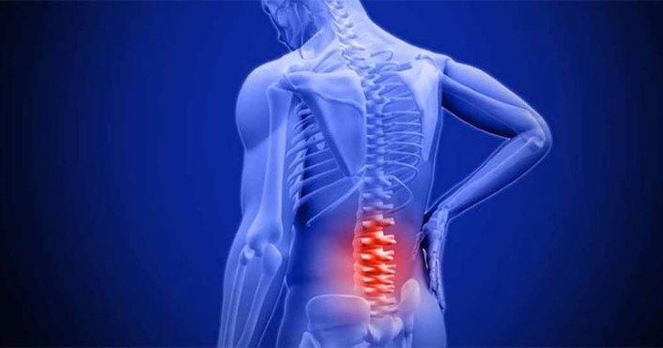 Thoái hóa cột sống lưng: Cần phân biệt với bệnh khác và cách phòng ngừa hiệu quả - Ảnh 1.