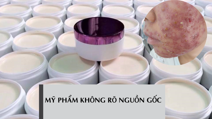 Cắt cơn “nghiện” cho da lệ thuộc kem chứa corticoid - Ảnh 1.