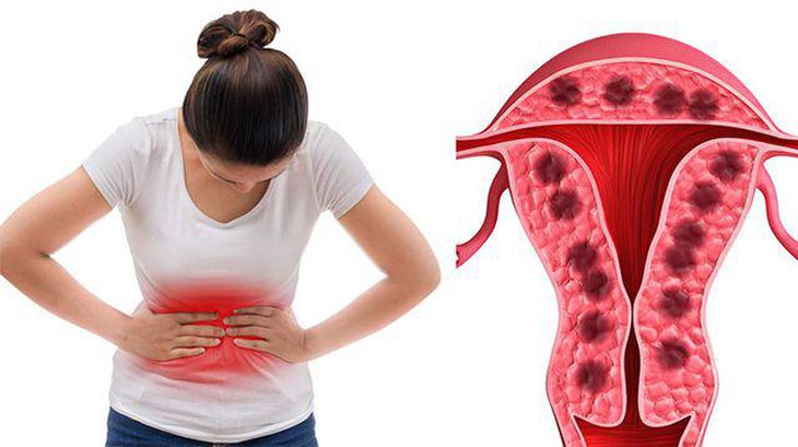 Tại sao phụ nữ lại có kinh nguyệt? - Ảnh 2. Tại sao phụ nữ lại có kinh nguyệt? - Ảnh 2.