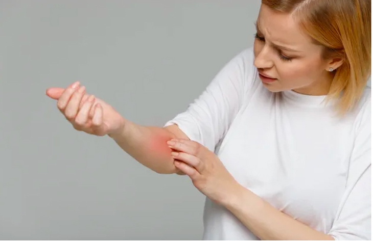 Những dấu hiệu cho thấy bạn bị mắc bệnh đậu mùa khỉ - Ảnh 3.