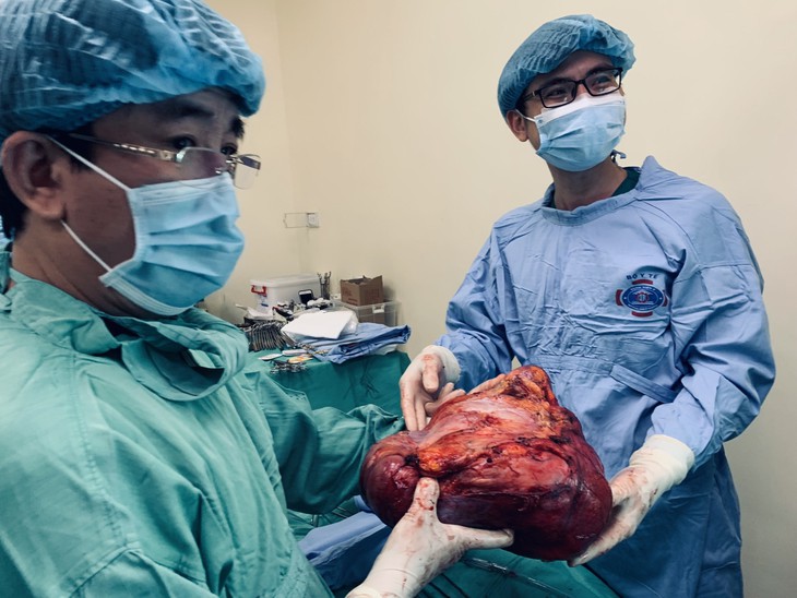 Người phụ nữ chướng bụng, ăn uống khó tiêu, bác sĩ 'bóc' ra khối u khủng đường kính 40 cm - Ảnh 1. Người phụ nữ chướng bụng, ăn uống khó tiêu, bác sĩ 'bóc' ra khối u khủng đường kính 40 cm - Ảnh 1.