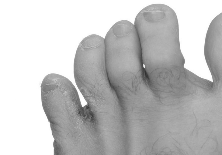 Mùa mưa bão: bệnh hay gặp và cách khắc phục - Ảnh 1.