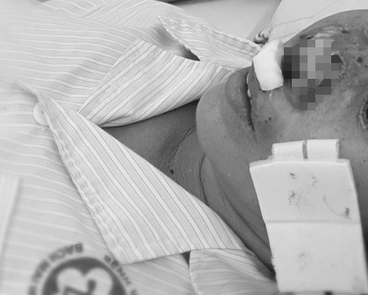 Cách nào phòng loại bệnh bị gọi là do "khuẩn ăn thịt người"? - Ảnh 3.