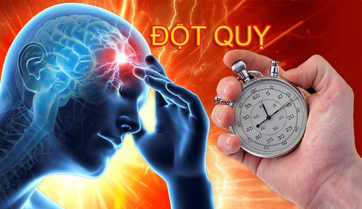 Đột quỵ là gì? Khi nào cần đến bệnh viện để điều trị? - Ảnh 1.