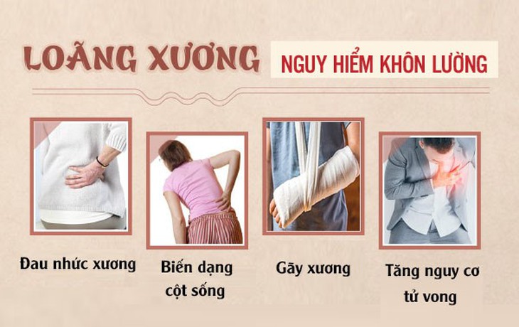 Tuổi già “xanh” nhờ dự phòng và điều trị loãng xương đúng cách - Ảnh 2.