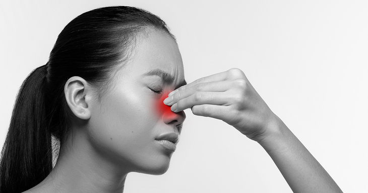 Viêm xoang tái phát mùa mưa, giảm nghẹt mũi - nhức đầu sao cho hiệu quả? - Ảnh 2.